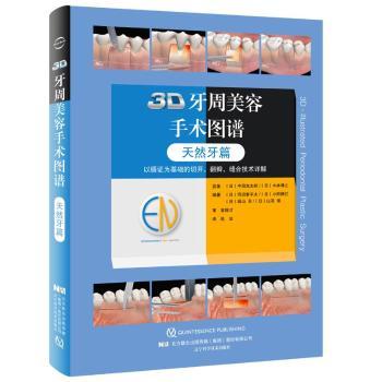 3DgDV
