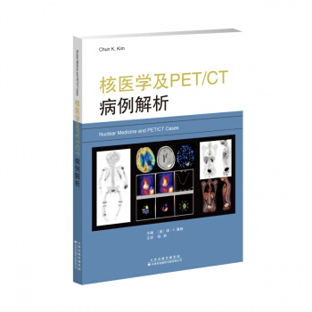 t(y)WPET/CT