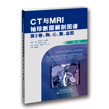 CTcMRIӽʈDV 2-ǻ