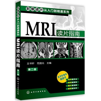 ӰxƬT(mn)ͨϵ--MRIxƬָ(ڶ)(t(y)W(xu)Ӱ(li)N(xio)(sh)(j)ٰNRȫͣDƬጸԔM)